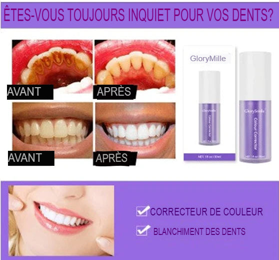 Sérum Ultra Blanchissant Dentaire